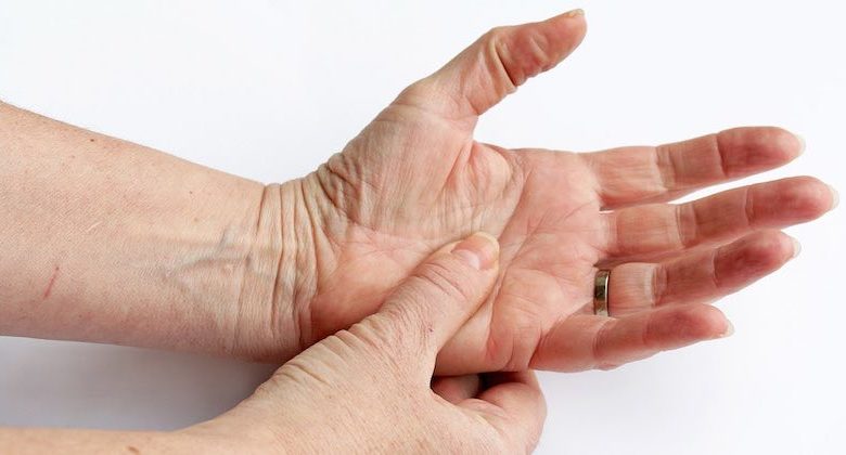 preparati medicinali per artrite reumatoide