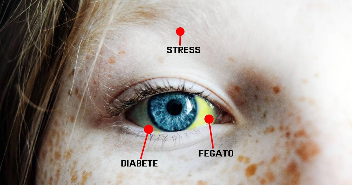 occhi possono rivelare sul tuo stato di salute