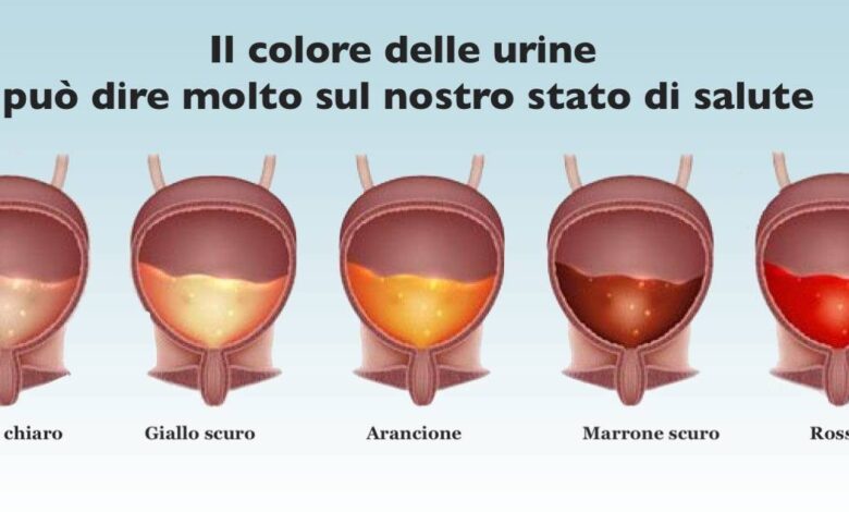 Il colore delle urine rivela delle importanti informazioni