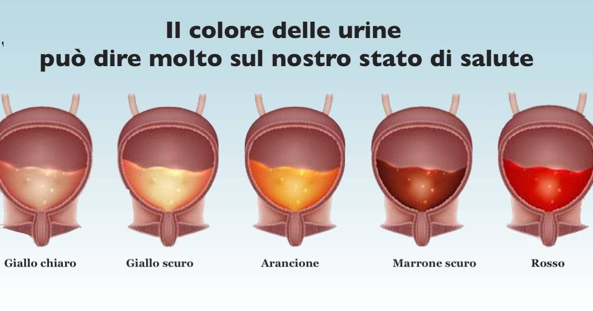 Il colore delle urine rivela delle importanti informazioni