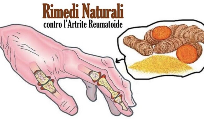 artrite reumatoide rimedi naturali