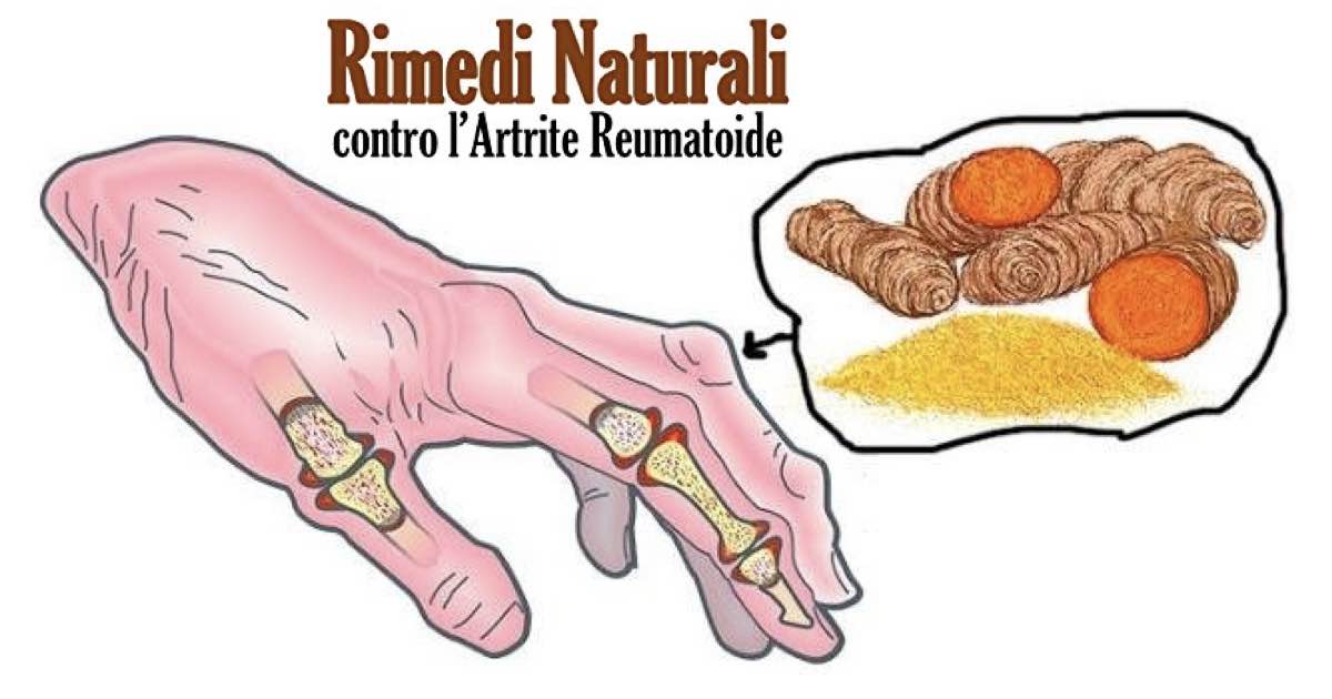 artrite reumatoide rimedi naturali