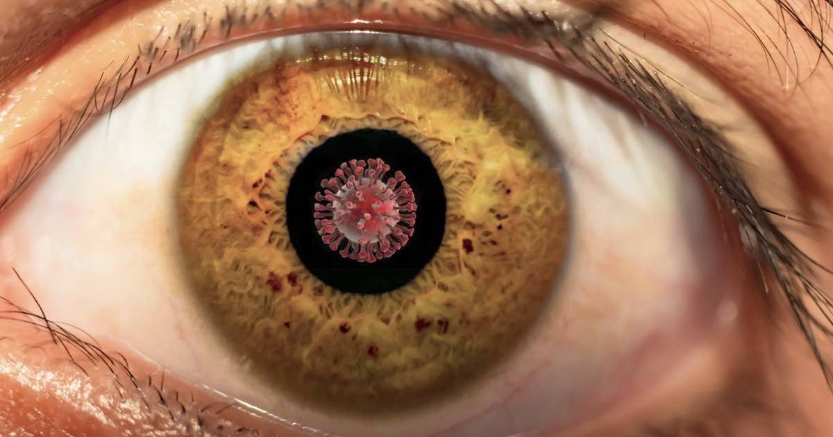 Il Covid-19 infettare cellule superficiali del occhio
