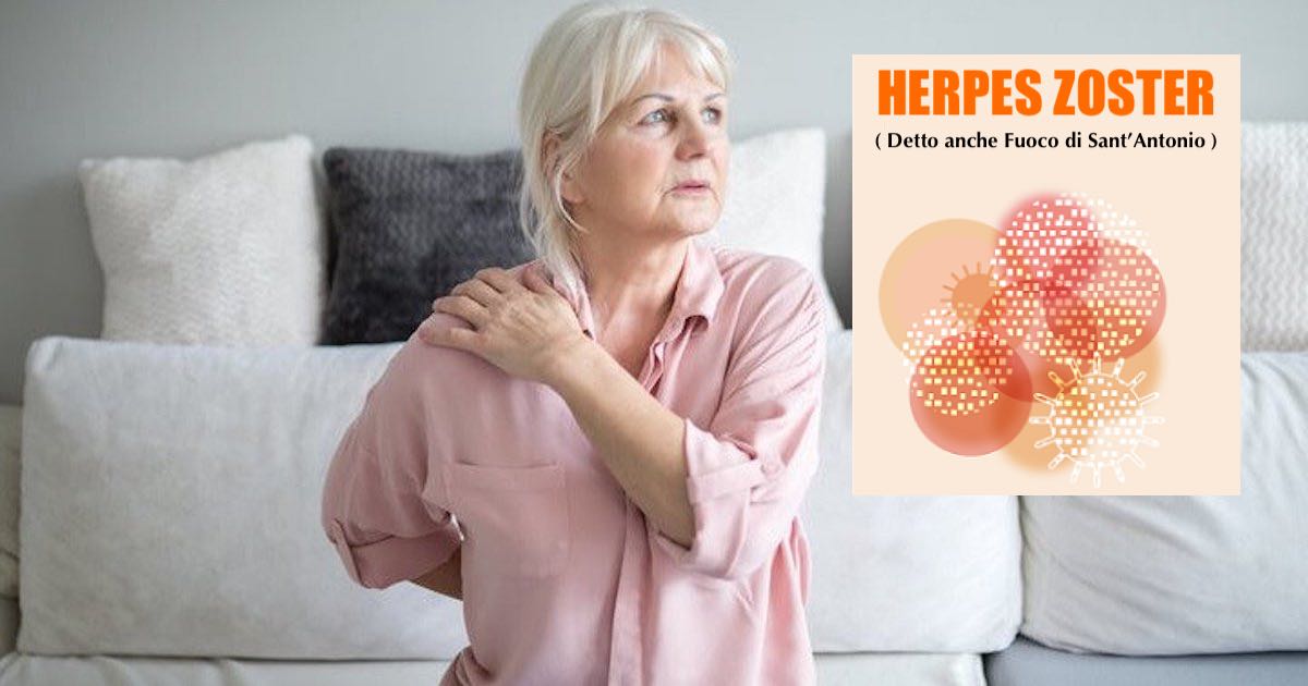 herpes zoster causa del mal di schiena