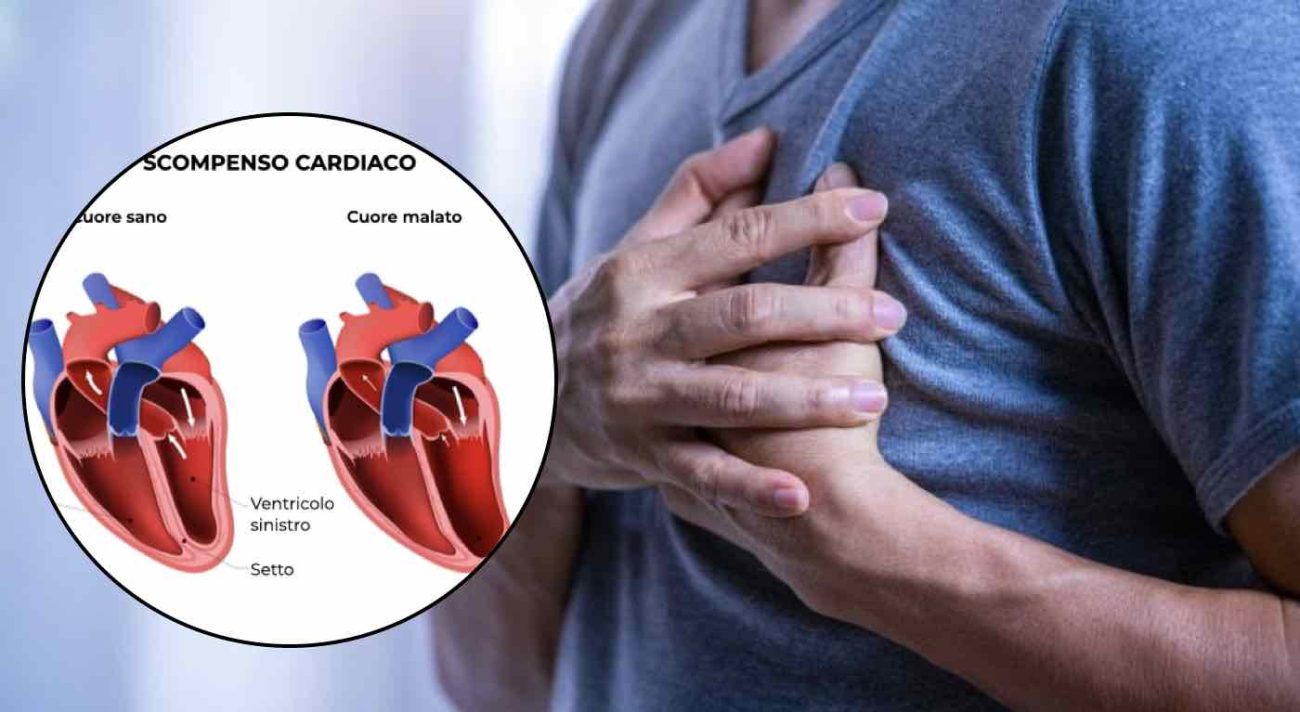 Insufficienza cardiaca